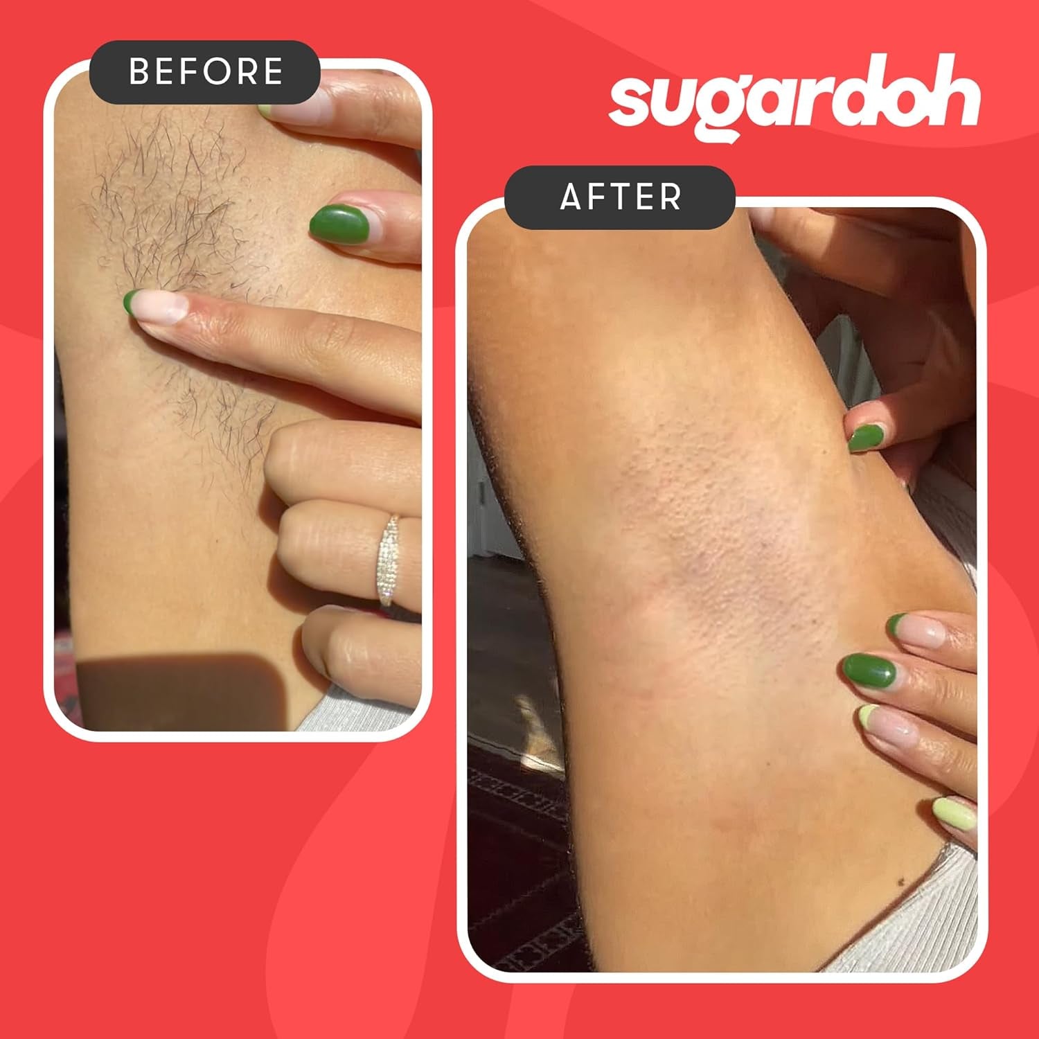 Ultimate Sugar Waxing Kit for Smooth, Hair-Free Skin